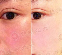 兰州北大皮肤科