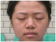 兰州北大皮肤科