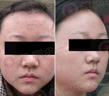 兰州北大皮肤科